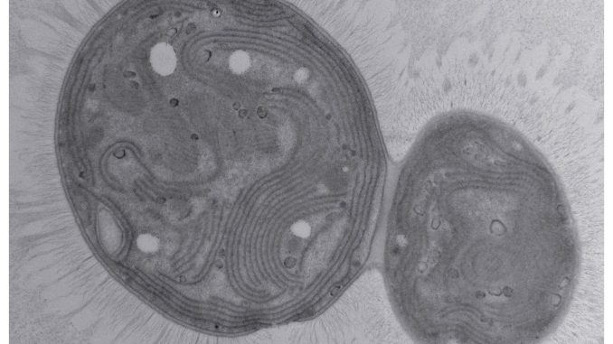 Spitzname „Chonkus“: Neu entdecktes Bakterium könnte Schlüssel für CO2-Abbau sein